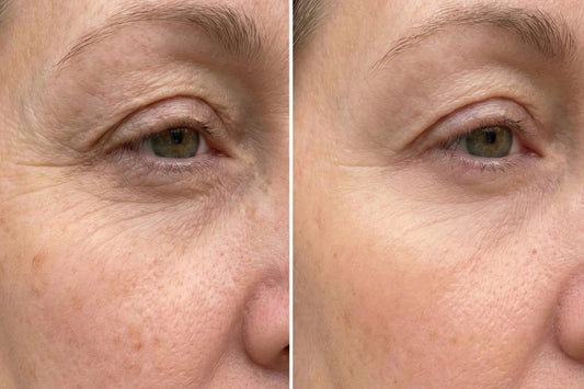 When Your Skin Starts Changing and No One Prepared You For It